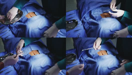 在手术室里做手术的外科医生高清在线视频素材下载