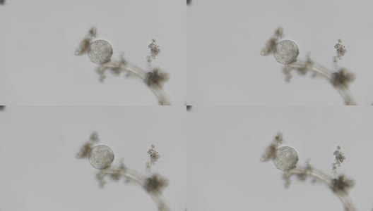 显微镜下微生物的幼虫，胚胎高清在线视频素材下载