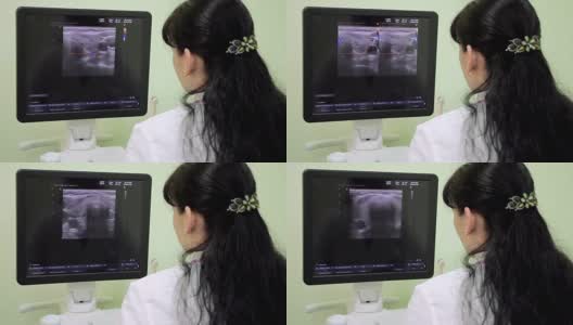 女医生放射学家在医院的电脑显示器屏幕上分析医学影像。放射学病房。放射科医生对病人进行了分析。医生进行体检高清在线视频素材下载