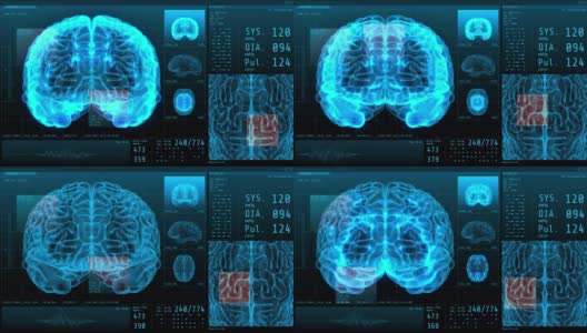 3D脑和生命体征统计数据神经病学显示高清在线视频素材下载