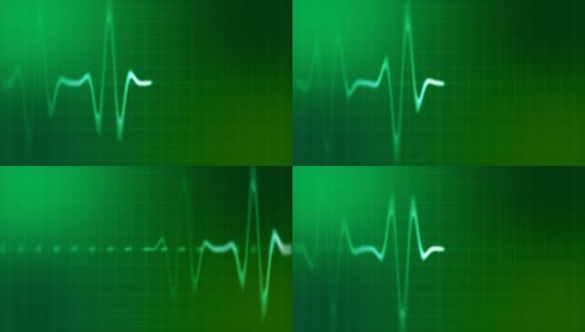 心电监护仪的心跳高清在线视频素材下载