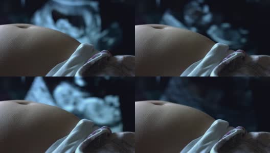 4K孕妇腹部超声与监视器背景高清在线视频素材下载