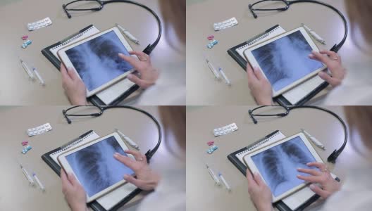 Сlose-up一位医生在平板上检查x光片高清在线视频素材下载
