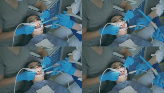 年轻女子坐在牙科椅上，张着大嘴。牙医与护士清洁和抛光牙齿高清在线视频素材下载