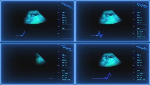 未来医学婴儿超声在蓝色调医院妊娠脉搏筛。x射线高清在线视频素材下载