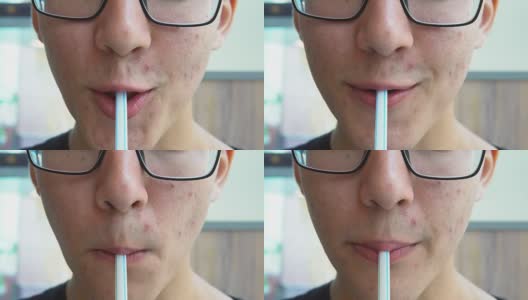 一个脸上长了粉刺的年轻人用吸管喝汽水。高清在线视频素材下载
