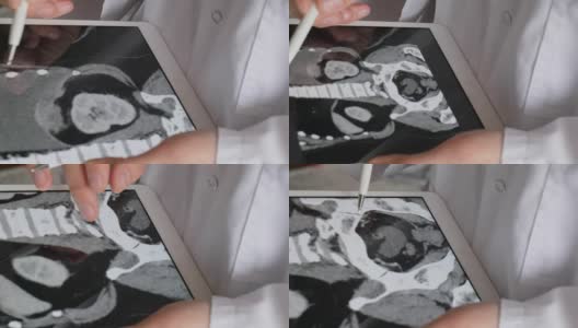 医生检查腹腔计算机断层扫描高清在线视频素材下载