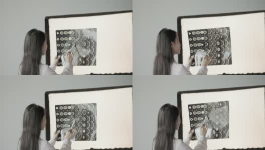 图为，一名亚洲女医生正在检查CT影像，并在光线下观察自己的身体状况高清在线视频素材下载