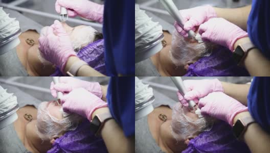 一个女人躺在一个皮肤科医生办公室的沙发上接受整容手术。二氧化碳磨高清在线视频素材下载