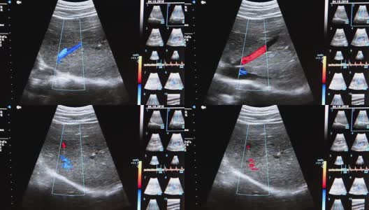 超声研究高清在线视频素材下载