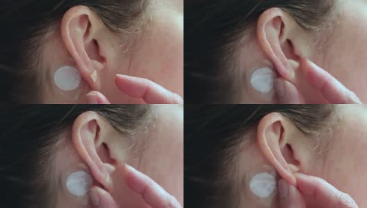 妇女在耳鸣问题上对针刺磁铁施加压力高清在线视频素材下载