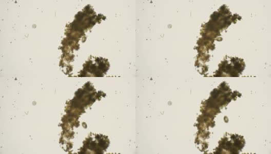 显微镜下的纤毛滴虫高清在线视频素材下载