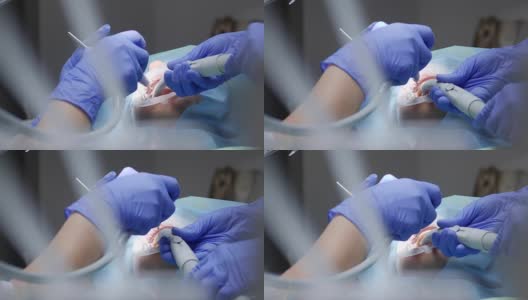 医学研究中，医生在橡胶无菌手套的帮助下用专用牙科器械清洗病人的牙齿高清在线视频素材下载