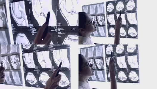 医生通过关节的x光片检查。关节的MRI快照。高清在线视频素材下载