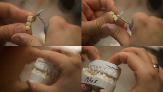 牙科技术员正在制作假牙高清在线视频素材下载
