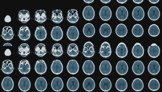 CT脑部图像与滑动高清在线视频素材下载
