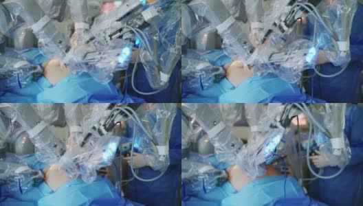 手术室微创机器人手术。医用外科机器人为病人做手术。高科技医疗机器人。高清在线视频素材下载