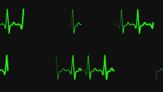 心脏脉搏图绿线白心高清在线视频素材下载