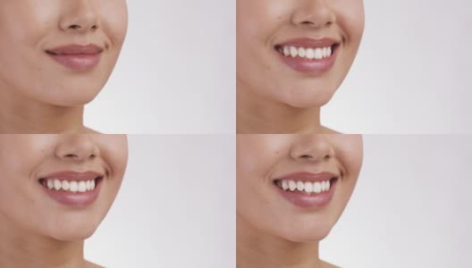 健康的牙齿。近距离的女人微笑广泛，展示完美的微笑，白色的工作室背景，空的空间高清在线视频素材下载