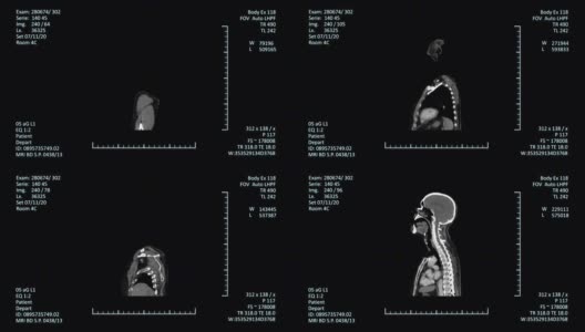 医学CT或CAT图像MRI扫描仪显示高清在线视频素材下载