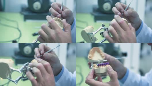 牙科技师用手术刀去除假牙上多余的蜡高清在线视频素材下载