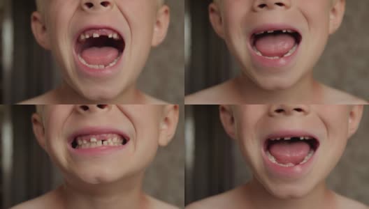 一个小男孩的特写镜头显示了他脱落的乳牙。高清在线视频素材下载