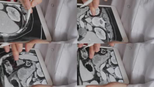 医生检查腹腔ct高清在线视频素材下载