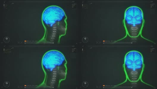 患者脑部扫描测试结果显示，疾病诊断与预防高清在线视频素材下载