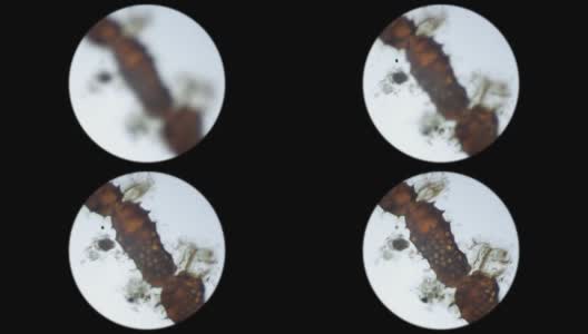 在显微镜下观察被保护壳中的微生物卵高清在线视频素材下载