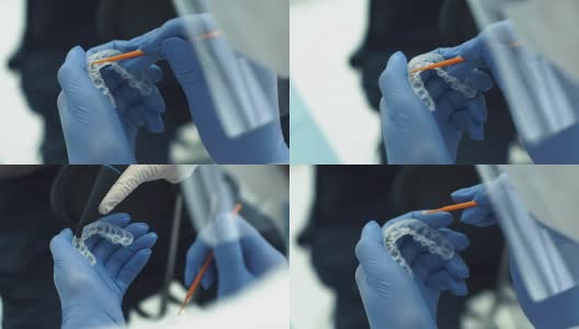 近距离拍摄的医生的手在手套工作与硅胶口腔保护高清在线视频素材下载
