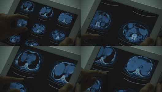 腹部扫描高清在线视频素材下载