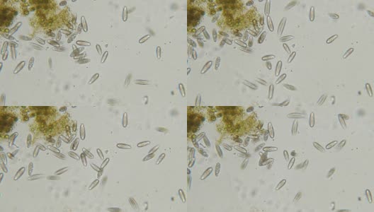 四膜虫是显微镜下的单细胞纤毛原生动物和细菌属高清在线视频素材下载