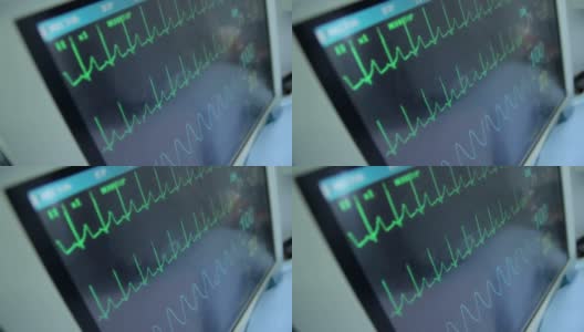 带数据的心电图监护仪高清在线视频素材下载