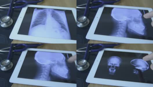 医生在平板电脑上检查x射线图像高清在线视频素材下载