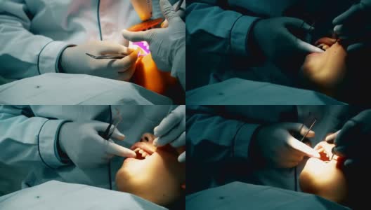 牙科医生正在给病人补牙高清在线视频素材下载
