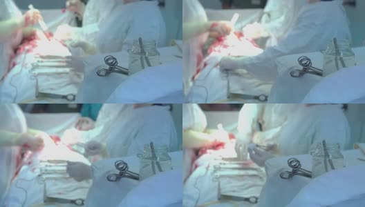 医院里的医生穿着防护服使用设备进行手术。高清在线视频素材下载