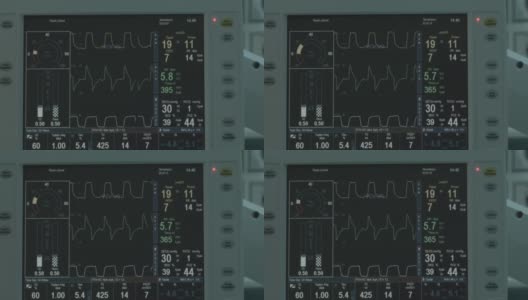 心脏节律的设备高清在线视频素材下载