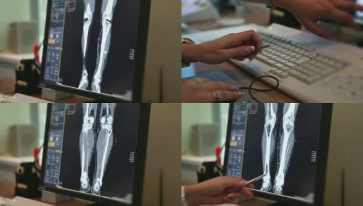 医学。计算机断层扫描。高清在线视频素材下载
