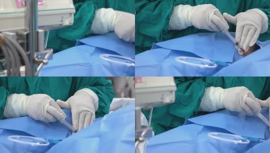 麻醉医师在大手术前对患者进行中心静脉压力监测高清在线视频素材下载
