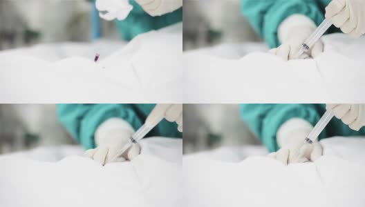 麻醉师使用针刺高清在线视频素材下载