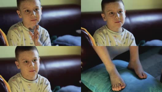 男孩患水痘坐着高清在线视频素材下载