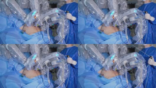 未来外科手术设备操作病人。手术过程中机械臂移动缓慢。站在手术台后面的外科医生。高清在线视频素材下载