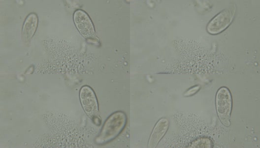 单细胞动物(滴虫)在显微镜下的运动。在湖水中显微镜下观察的纤毛虫柱头藻群落。关闭了。UHD 4 k高清在线视频素材下载