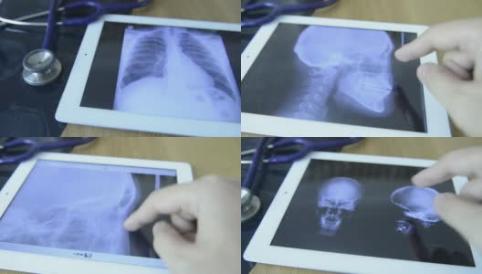Doctors Examining X-Ray Image On A Tablet高清在线视频素材下载