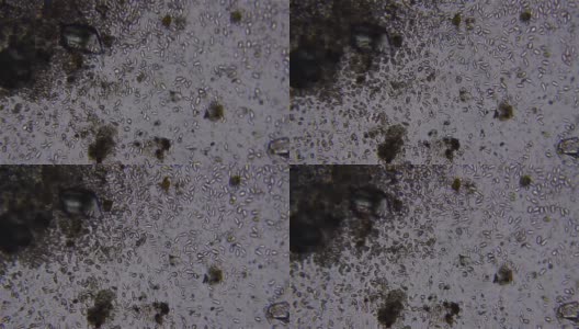 在光学显微镜下观察到的搅拌微生物高清在线视频素材下载