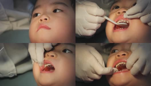 牙医小心翼翼地反复调整亚洲宝宝的牙套。高清在线视频素材下载
