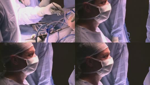 外科医生使用现代器械进行手术高清在线视频素材下载