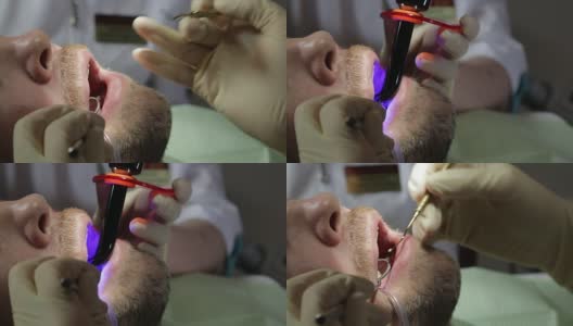 治疗后的牙科检查高清在线视频素材下载
