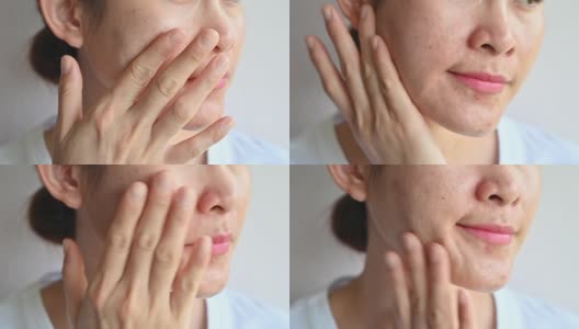 亚洲女性使用保湿霜治疗和改善她老化的皮肤。高清在线视频素材下载