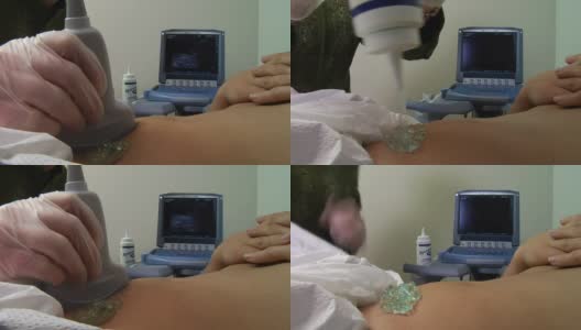 超声检查妊娠高清在线视频素材下载